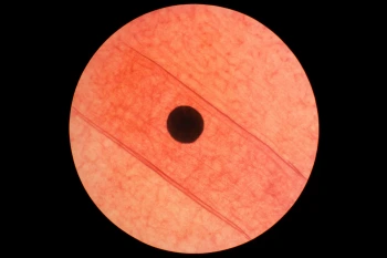 Identify the Organelle
