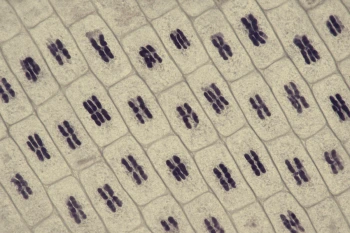 Phases of Mitosis